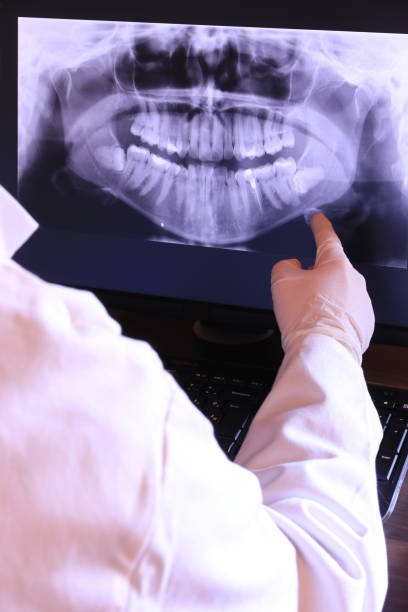Best Same-Day Emergency Dental Services in Anson, TX