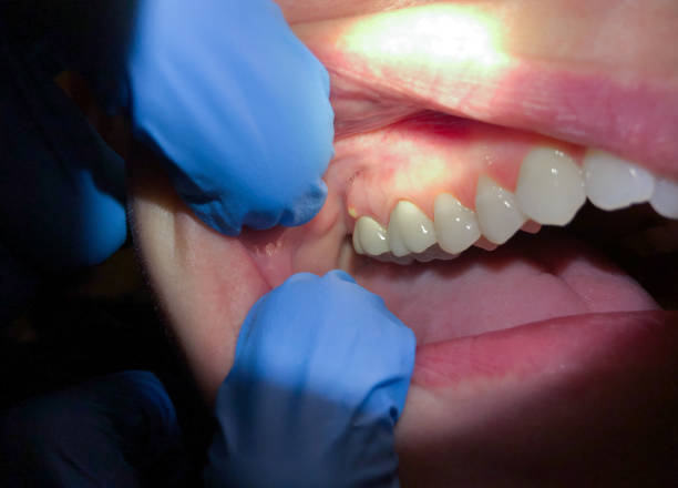 Best Pediatric Emergency Dentist in Anson, TX